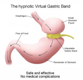 gastric